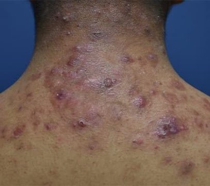 Skin and Hair Clinic