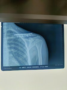 𝗣𝗿𝗼𝗳. 𝗗𝗿 𝗣𝘂𝘀𝗽𝗮𝗸 𝗦𝗮𝗺𝗮𝗹 - Best Orthopedic Surgeon in Bhubaneswar/Joint Replacement/Spine Surgeon in Bhubaneswar