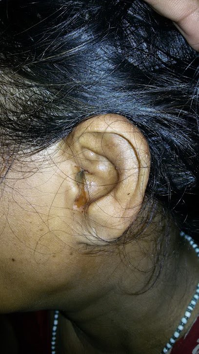 Dr. RAJAT DASH ( ENT SPECIALIST, RGH )